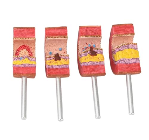 Arterienanatomiemodell mit Arteriosklerose-Thrombus-Gefäßmodell for Ärzte, pädagogisches Werkzeug von Xinzhai