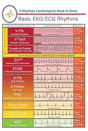YAASIMOULE Wanddekoration, Wohndekor, Dekorationsraum Basic Ekg Ekg Rthythms von YAASIMOULE