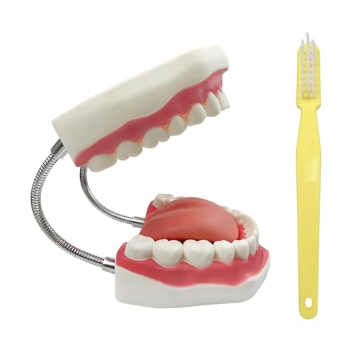 YOUYA DENTAL 6-faches Zähneputzen Lehrmodell Zahnzerfall Evolution Display-Tools für Unterricht und Studium (Nicht abnehmbare Zähne Modell)) von YOUYA DENTAL