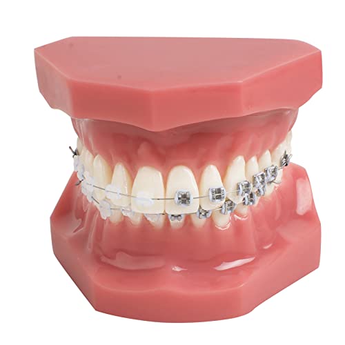 YOUYA DENTAL Demonstration Kiefergerechte Modellzähne Lehr-Werkzeuge mit Metall- und Keramik-Halterung Rot TM-208 1 YOUYA DENTAL Demonstration Kiefergerechte Modellzähne Lehr-Werkzeuge mit Metall- und Keramik-Halterung Rot TM-208 1 von YOUYA DENTAL
