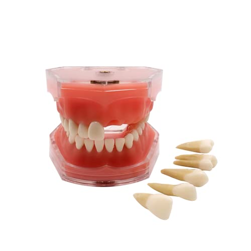 YOUYA Dental-Demonstration, Standard-Zahn-Modell, Lehrmodell, Lernwerkzeug, weiches Zahnfleisch, mit 28 abnehmbaren Zähnen von YOUYA DENTAL