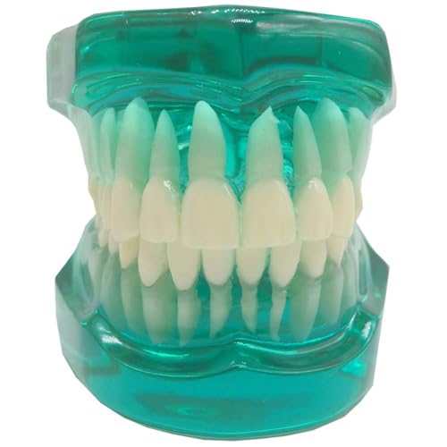 Transparentes Zahnprothesenmodell, nicht abnehmbarer Ober- und Unterkiefer mit sichtbaren Wurzeln for die mündliche Lehre, Patientenaufklärung Transparentes Zahnprothesenmodell, nicht abnehmbarer Ober- und Unterkiefer mit sichtbaren Wurzeln for die mündliche Lehre, Patientenaufklärung von YUIHATF