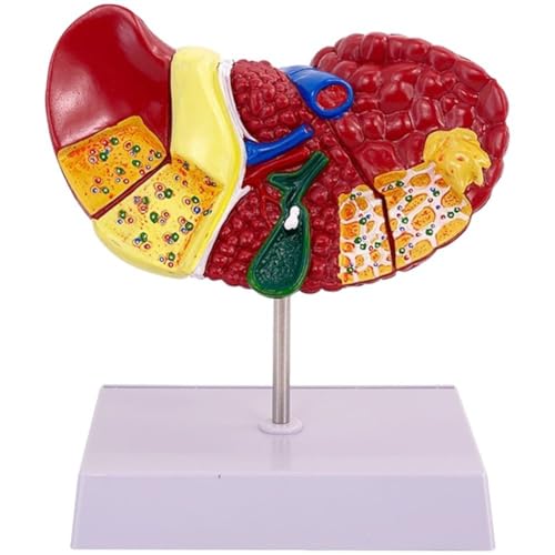 Ymxygz Anatomisches Modell Der Pathologischen Leber 1:1-anatomiemodell des Menschlichen Lebermodells Für Das Studium Und Die Forschung an Medizinischen Fakultäten Ymxygz Anatomisches Modell Der Pathologischen Leber 1:1-anatomiemodell des Menschlichen Lebermodells Für Das Studium Und Die Forschung an Medizinischen Fakultäten von Ymxygz