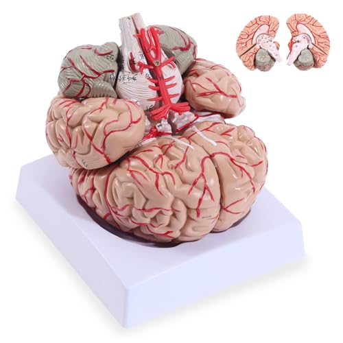 Menschliches Gehirn Arterie Modell, Lebensgroßes Anatomisches Modell des Menschlichen Gehirns, Abnehmbare 9 Teile für Medizinischen Unterricht und Studium Menschliches Gehirn Arterie Modell, Lebensgroßes Anatomisches Modell des Menschlichen Gehirns, Abnehmbare 9 Teile für Medizinischen Unterricht und Studium von YonGYun