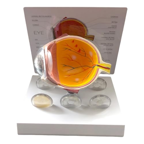 Anatomisches menschliches Augenmodell, pathologisches Augapfel-Anatomie-Modell für klinische Einstellungen, Lehren, Vorlesungsbericht, Augenanatomie-Display von ZORESCOLEO