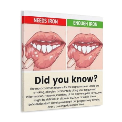 ZOZO HOUSE Iron Deficiency in The Mouth Wandkunst 12x12inch(30x30cm) von ZOZO HOUSE