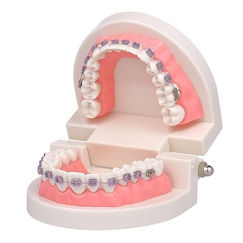 ZWDCVFGK Kieferorthopädisches Zahnmodell, mit kieferorthopädischer Metallhalterung für Zahnarztlehrforschung, Dentallabor von ZWDCVFGK