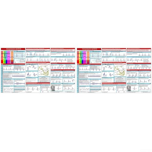 Rhythm Interpretation Pocket Cards for Professionals Comprehensive Guide for AV Block and Bundle Branch Block Rhythm Interpretation Pocket Cards for Professionals Comprehensive Guide for AV Block and Bundle Branch Block von ZYNCUE