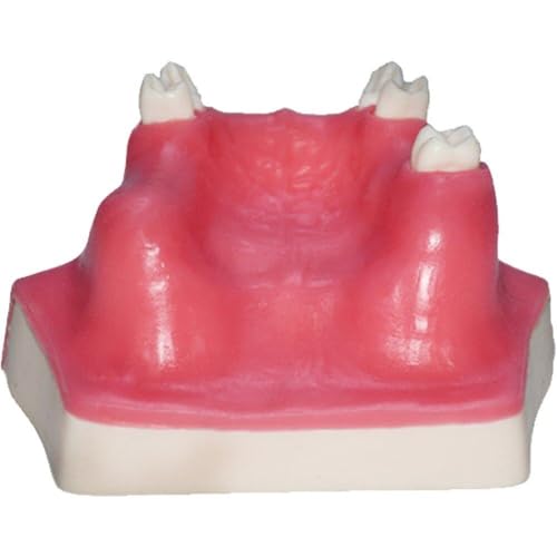 Dental Implantat Lehre Modell Oberkiefer Kieferhöhlen Modell Zähne Modell Dental Lehre Modell Für Zahnarzt Student Studieren von Zghhc
