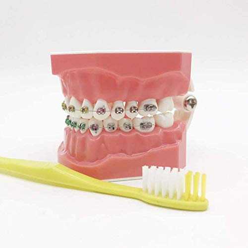 Zähne Modell Für Ausbildung - KFO-Modell - Zähne Lehr-Modell Mit Metall Und Keramik Bracket - Zähne Modell Korrektive Trainingsmodell Für Kinder Oral Care Lehre,A Zähne Modell Für Ausbildung - KFO-Modell - Zähne Lehr-Modell Mit Metall Und Keramik Bracket - Zähne Modell Korrektive Trainingsmodell Für Kinder Oral Care Lehre,A von Zhenwo