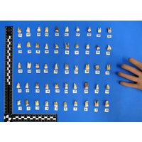 Echte Menschliche Zähne. Zähne Zum Dekorieren Und Basteln. Für Schmuckverarbeitung U.a Echte Menschliche Zähne. Zähne Zum Dekorieren Und Basteln. Für Schmuckverarbeitung U.a von bastelknochen