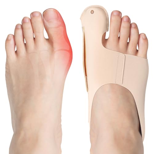 flintronic Hallux Valgus Korrektur,2PCS Zehenspreizer Hallux Valgus Korrektur Set, Hallux Valgus Bandage für Herren und Damen Schutz der großen Zehe (Hautfarbe, M) von flintronic