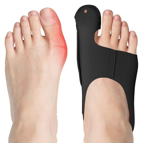 flintronic Hallux Valgus Korrektur, 2PCS Zehenspreizer Hallux Valgus Korrektur Set, Hallux Valgus Bandage für Herren und Damen Schutz der großen Zehe (Schwarz, L) von flintronic