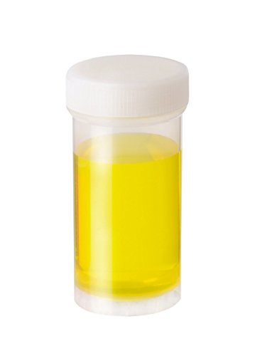 neoLab Polypropylen Versandgefäß mit Blau Schraubverschluss, Transparent, 50ml Kapazität, 39mm x 74mm, 500 Stück von neoLab